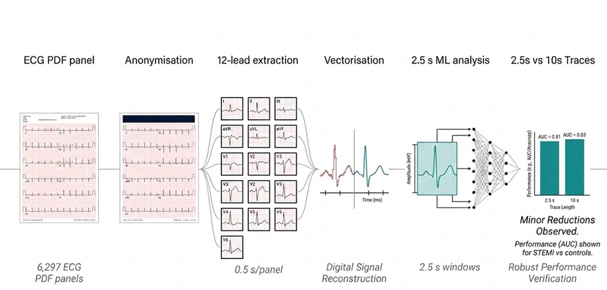 Automated digitisation of ECG PDF panels for AI-based acute myocardial infarction classification: impact of short signal windows on machine learning performance